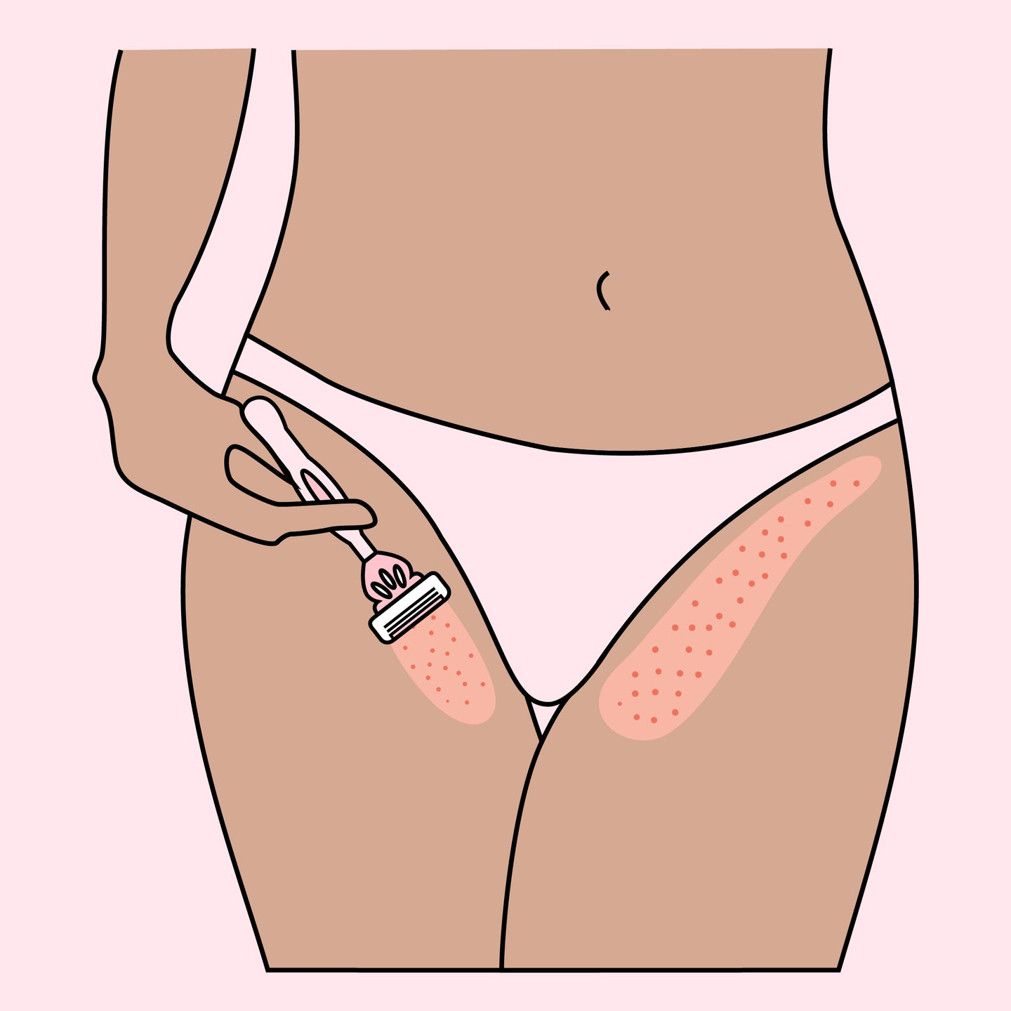illustration of woman shaving pubic area and trying to prevent razor burn