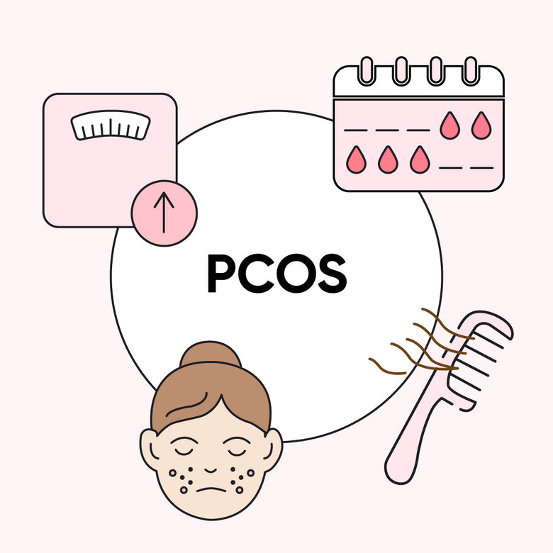 pcos symptoms illustration